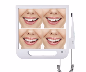 Cámara intraoral (Con monitor y brazo)